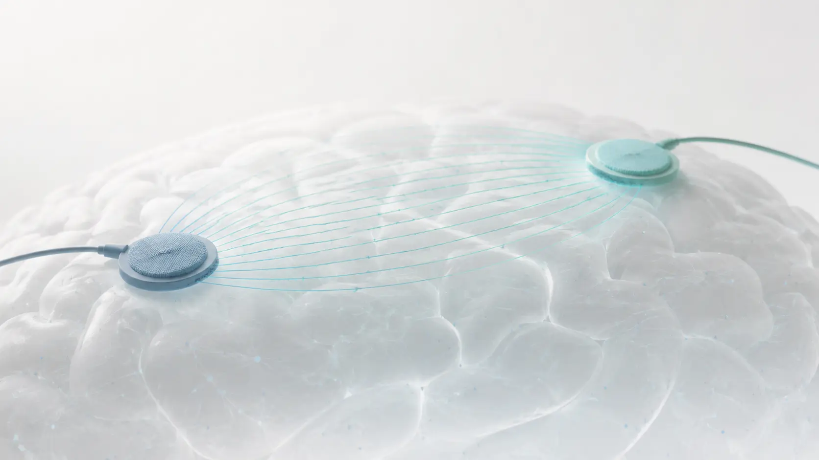 Mapa topográfico abstracto entre puntos de estimulación para explicar tDCS